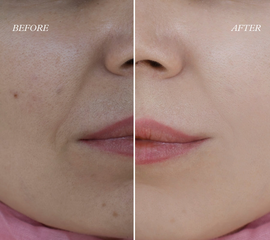 Lā SEN Oasis Facelift Ritual | Starter Kit (1 Treatment)