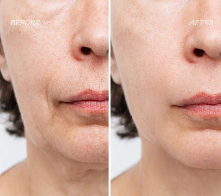 Weekly Oasis™ Facelift Gel Mask | Starter Kit